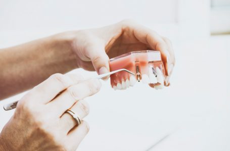 Implantul dentar – din ce este compus și care sunt etapele intervenției?